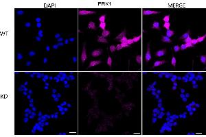 Immunocytochemical staining of HeLa cells using ERK1 antibody (ABIN7799450), 1:1,000), Top panel: wild-type (WT), Bottom panal: ERK1 shRNA knockdown (KD). (Recombinant ERK1 antibody)