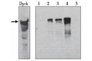 Image no. 1 for anti-Dual-Specificity tyrosine-(Y)-phosphorylation Regulated Kinase 1A (DYRK1A) (AA 486-763) antibody (ABIN264978) (DYRK1A antibody  (AA 486-763))