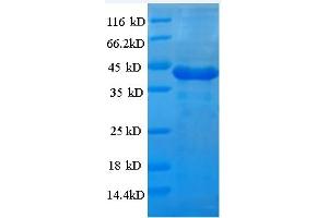 SDS-PAGE (SDS) image for Casein Kinase 1, alpha 1 (CSNK1A1) (AA 2-337) protein (His tag) (ABIN5709341)