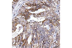 IHC analysis of Rab4/RAB4A using anti-Rab4/RAB4A antibody (ABIN7599733). (Rab4 antibody  (AA 110-216))
