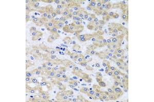 Immunohistochemistry of paraffin-embedded human liver injury using PEX3 antibody (ABIN5975508) at dilution of 1/100 (40x lens). (PEX3 antibody)
