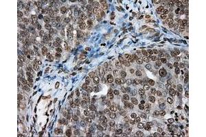Immunohistochemical staining of paraffin-embedded Kidney tissue using anti-DAPK2 mouse monoclonal antibody. (DAPK2 antibody)