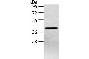 Western Blot analysis of Hepg2 cell using PTX3 Polyclonal Antibody at dilution of 1:400 (PTX3 antibody)