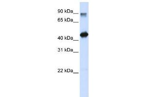 Western Blotting (WB) image for anti-High-Mobility Group 20A (HMG20A) antibody (ABIN2458385) (HMG20A antibody)