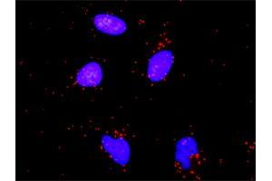 Proximity Ligation Analysis of protein-protein interactions between IKBKB and NFKB1. (NFKB1 antibody  (AA 860-969))