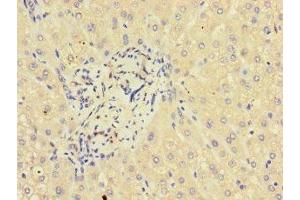 Immunohistochemistry of paraffin-embedded human liver tissue using ABIN7154242 at dilution of 1:100 (GLT8D1 antibody  (AA 33-332))