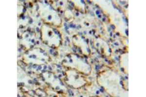 Used in DAB staining on fromalin fixed paraffin-embedded Spleen tissue (IL27 Receptor alpha antibody  (AA 123-343))