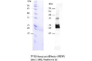 Image no. 2 for TP53 Apoptosis Effector (PERP) (AA 1-193) protein (rho-1D4 tag) (ABIN3105096)