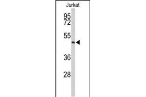 Western blot analysis of ACR Antibody (C-term) (ABIN653021 and ABIN2842643) in Jurkat cell line lysates (35 μg/lane). (Acrosin antibody  (C-Term))