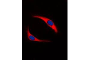 Immunofluorescent analysis of SYK (pY323) staining in Ramos cells. (SYK antibody  (pTyr323))