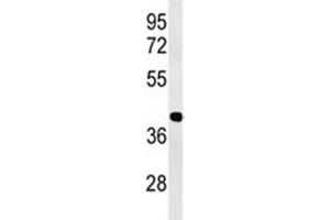 Western blot analysis of ATF1 antibody and Jurkat lysate (AFT1 antibody  (AA 193-219))