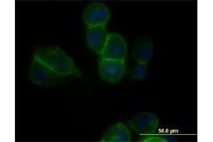 Immunofluorescence of monoclonal antibody to CDH11 on PC3-MM2 cell. (OB Cadherin antibody  (AA 54-612))