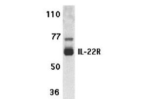 Western Blotting (WB) image for anti-Interleukin 22 Receptor (IL22R) (N-Term) antibody (ABIN1031411) (IL22R antibody  (N-Term))