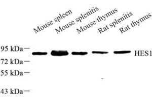 Western blot analysis of HS1 (ABIN7074187) at dilution of 1: 500 (HCLS1 antibody)