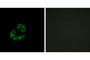 Peptide - +Western blot analysis of extracts from Jurkat cells, using ARFIP1 antibody. (ARFIP1 antibody)