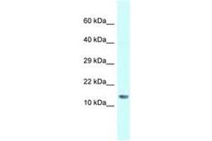 Image no. 1 for anti-Small Nuclear Ribonucleoprotein D1 Polypeptide 16kDa (SNRPD1) (N-Term) antibody (ABIN6747659)