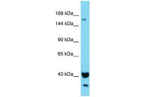 Western Blotting (WB) image for anti-KIAA1683 (KIAA1683) (N-Term) antibody (ABIN2791618) (KIAA1683 antibody  (N-Term))