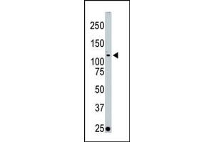 Image no. 1 for anti-Serine/threonine Kinase 10 (STK10-A) (C-Term) antibody (ABIN360364) (STK10-A antibody  (C-Term))