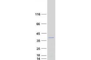 Validation with Western Blot (GEMIN8 Protein (Transcript Variant 3) (Myc-DYKDDDDK Tag))