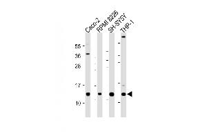 All lanes : Anti-CKS2 Antibody (C-Term) at 1:2000 dilution Lane 1: Caco-2 whole cell lysate Lane 2: RI 8226 whole cell lysate Lane 3: SH-SY5Y whole cell lysate Lane 4: THP-1 whole cell lysate Lysates/proteins at 20 μg per lane.