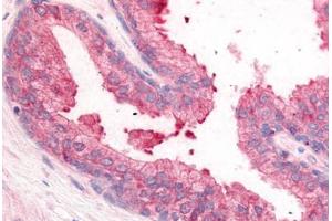 Human Prostate (formalin-fixed, paraffin-embedded) stained with PDE8A antibody ABIN213534 at 10 ug/ml followed by biotinylated goat anti-rabbit IgG secondary antibody ABIN481713, alkaline phosphatase-streptavidin and chromogen. (PDE8A antibody  (N-Term))