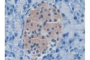 Detection of NLRP3 in Mouse Pancreas Tissue using Polyclonal Antibody to NLR Family, Pyrin Domain Containing Protein 3 (NLRP3) (NLRP3 antibody  (AA 671-1033))