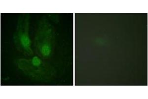 Immunofluorescence analysis of HeLa cells, using PKC zeta (Ab-410) Antibody. (PKC zeta antibody  (AA 376-425))