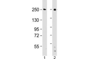 Western blot testing of human 1) Ramos and 2) THP-1 cell lysate with DOCK8 antibody at 1:2000. (DOCK8 antibody  (AA 2056-2090))