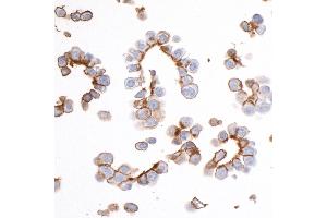 Immunocytochemistry (ICC) image for anti-Epithelial Cell Adhesion Molecule (EPCAM) (AA 264-314) antibody (ABIN7455204) (Recombinant EpCAM antibody  (AA 264-314))