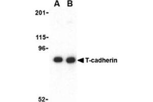 Image no. 1 for anti-Cadherin 13 (CDH13) (N-Term) antibody (ABIN318711) (Cadherin 13 antibody  (N-Term))