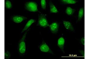 Immunofluorescence (IF) image for anti-Ubiquitin-Conjugating Enzyme E2N (UBE2N) (AA 1-152) antibody (ABIN563325)