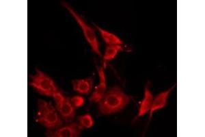 ABIN6276235 staining HepG2 by IF/ICC. (VIPR2 antibody  (Internal Region))
