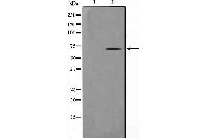 Western blot analysis on COLO205 cell lysate using NR4A3 Antibody,The lane on the left is treated with the antigen-specific peptide. (NR4A3 antibody)