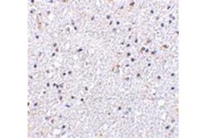 Immunohistochemistry of VISA in human brain tissue with this product at 5 μg/ml. (MAVS antibody  (N-Term))