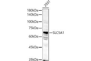 Western blot analysis of extracts of 293T cells, using SLC5 antibody (1976) at 1:500 dilution. (SLC5A1 antibody  (AA 350-450))