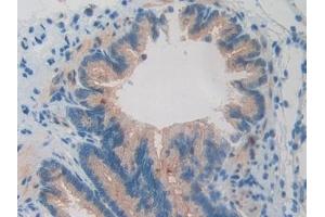 Detection of BMP15 in Rat Lung Tissue using Polyclonal Antibody to Bone Morphogenetic Protein 15 (BMP15) (BMP15 antibody  (AA 269-391))