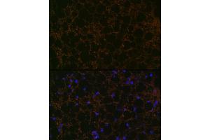 Immunofluorescence (IF) image for anti-Perilipin 1 (PLIN1) antibody (ABIN7269218)