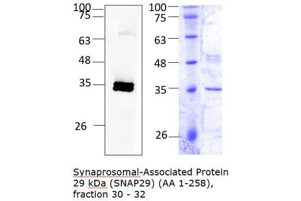 SNAP29 Protein (AA 1-258) (Strep Tag)
