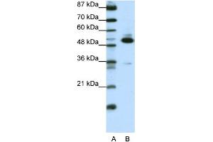 WB Suggested Anti-TADA3L Antibody Titration:  0. (TADA3L antibody  (C-Term))