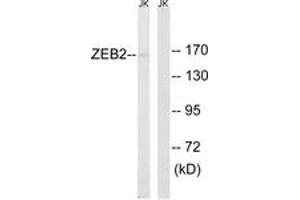 Western blot analysis of extracts from Jurkat cells, using ZEB2 Antibody. (ZEB2 antibody  (AA 71-120))