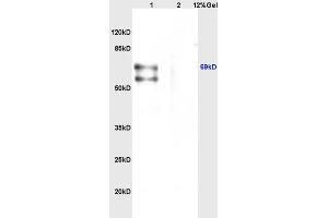 Lane 1: mouse brain lysates Lane 2: mouse heart lysates probed with Anti CHRNA4 Polyclonal Antibody, Unconjugated (ABIN736746) at 1:200 in 4 °C. (CHRNA4 antibody  (AA 531-627))