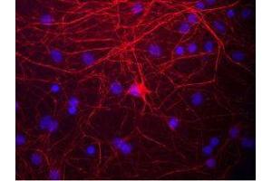 Image no. 1 for anti-Neurofilament Triplet M Protein (NEFM) antibody (ABIN956920) (NEFM antibody)