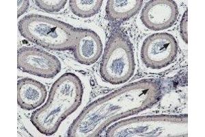 Expression of TRPM5 in rat testes - Immunohistochemical staining of rat epididymis paraffin embedded sections using Anti-TRPM5 Antibody (ABIN7043834, ABIN7044010 and ABIN7044011), (1:100). (TRPM5 antibody  (Intracellular))