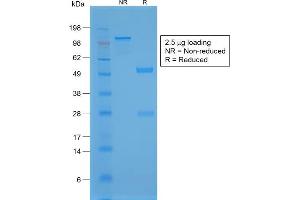 SDS-PAGE Analysis Purified TTF-1 Rabbit Recombinant Monoclonal Antibody (NX2.