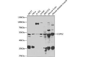 Western blot analysis of extracts of various cell lines, using COPS2 antibody (ABIN6130123, ABIN6138877, ABIN6138878 and ABIN6222819) at 1:1000 dilution. (COPS2 antibody  (AA 1-310))