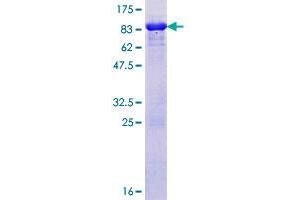 RAD23A Protein (AA 1-363) (GST tag)