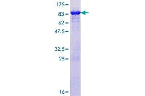 RAD23A Protein (AA 1-363) (GST tag)