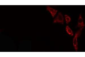 ABIN6276596 staining NIH-3T3 cells by IF/ICC. (PDGFB antibody  (N-Term))
