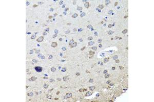 Immunohistochemistry of paraffin-embedded mouse brain using CHRNB2 antibody (ABIN6003540) at dilution of 1/100 (40x lens). (CHRNB2 antibody)