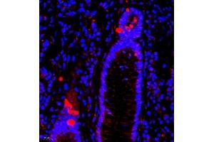Immunofluorescence of paraffin embedded human colon using SRP14 (ABIN7075596) at dilution of 1:300 (400x lens) (SRP14 antibody)